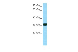 Aviva Systems Biology Corp RPS3 Antibody - C-terminal region (ARP63708_P050)