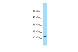 Aviva Systems Biology Corp PROK2 Antibody - middle region (ARP63758_P050)