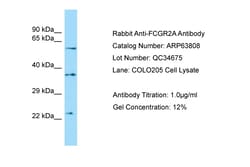 Aviva Systems Biology Corp FCGR2A Antibody - C-terminal region (ARP63808_P050)