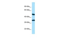 Aviva Systems Biology Corp CASQ2 Antibody - N-terminal region (ARP63849_P050)