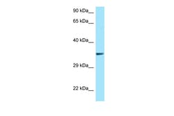 Aviva Systems Biology Corp QKI Antibody - N-terminal region (ARP63894_P050)