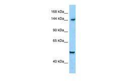 Aviva Systems Biology Corp DIAPH1 Antibody - C-terminal region (ARP63910_P050)