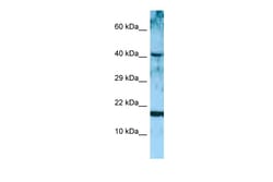 Aviva Systems Biology Corp ARTN Antibody - middle region (ARP63920_P050)