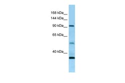 Aviva Systems Biology Corp ROR1 Antibody - N-terminal region (ARP63926_P050)