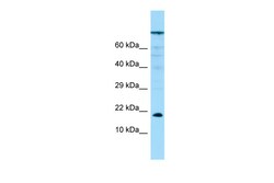 Aviva Systems Biology Corp PPP1R14A Antibody - N-terminal region (ARP63944_P050)