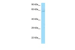 Aviva Systems Biology Corp PICALM Antibody - C-terminal region (ARP63958_P050)