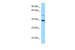 Aviva Systems Biology Corp STRA8 Antibody - C-terminal region (ARP63960_P050)