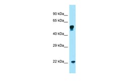 Aviva Systems Biology Corp COQ7 Antibody - C-terminal region (ARP64009_P050)