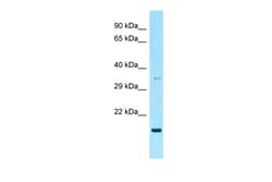 Aviva Systems Biology Corp RAP2A Antibody - C-terminal region (ARP64032_P050)