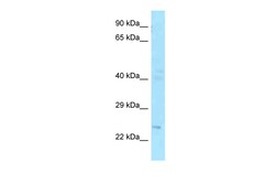 Aviva Systems Biology Corp FGF20 Antibody - C-terminal region (ARP64045_P050)