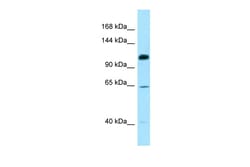 Aviva Systems Biology Corp SMC6 Antibody - C-terminal region (ARP64076_P050)