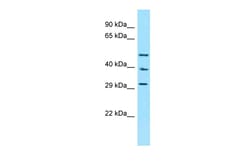 Aviva Systems Biology Corp CCKAR Antibody - N-terminal region (ARP64107_P050)