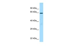 Aviva Systems Biology Corp BCO1 Antibody - middle region (ARP64137_P050)