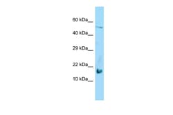 Aviva Systems Biology Corp LGALS7 Antibody - middle region (ARP64143_P050)