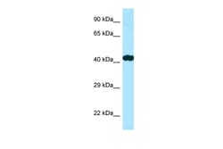 Aviva Systems Biology Corp RILP Antibody - C-terminal region (ARP64148_P050)