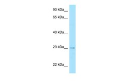 Aviva Systems Biology Corp STC2 Antibody - C-terminal region (ARP64151_P050)