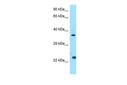 Aviva Systems Biology Corp WISP2 Antibody - C-terminal region (ARP64152_P050)