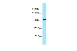 Aviva Systems Biology Corp COQ6 Antibody - C-terminal region (ARP64160_P050)