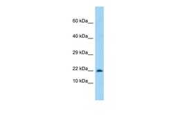 Aviva Systems Biology Corp MARCKSL1 Antibody - C-terminal region (ARP64193_P050)
