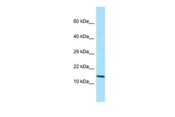 Aviva Systems Biology Corp GCSH Antibody - C-terminal region (ARP64203_P050)