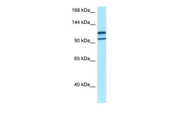 Aviva Systems Biology Corp MYO10 Antibody - C-terminal region (ARP64209_P050)