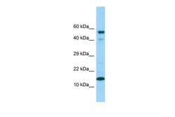 Aviva Systems Biology Corp CDK2AP1 Antibody - C-terminal region (ARP64230_P050)