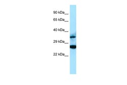 Aviva Systems Biology Corp RASSF2 Antibody - C-terminal region (ARP64234_P050)