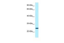 Aviva Systems Biology Corp SOSTDC1 Antibody - C-terminal region (ARP64262_P050)