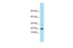 Aviva Systems Biology Corp RAP2B Antibody - C-terminal region (ARP64354_P050)