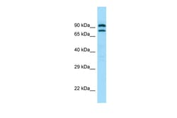 Aviva Systems Biology Corp PDE4C Antibody - C-terminal region (ARP64361_P050)