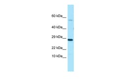 Aviva Systems Biology Corp PDE7A Antibody - C-terminal region (ARP64420_P050)