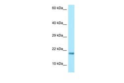 Aviva Systems Biology Corp RPS17 Antibody - middle region (ARP64463_P050)