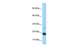 Aviva Systems Biology Corp RPS17 Antibody - C-terminal region (ARP64464_P050)