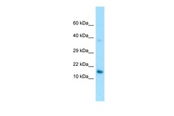 Aviva Systems Biology Corp GPIHBP1 Antibody - C-terminal region (ARP64479_P050)