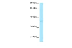 Aviva Systems Biology Corp TP53I3 Antibody - C-terminal region (ARP64532_P050)