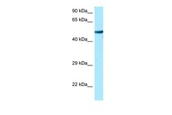 Aviva Systems Biology Corp TUBA1A Antibody - C-terminal region (ARP64533_P050)