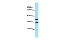 Aviva Systems Biology Corp AKR1A1 Antibody - C-terminal region (ARP64535_P050)