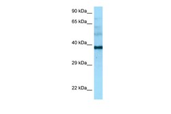Aviva Systems Biology Corp NAPSA Antibody - middle region (ARP64545_P050)