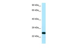 Aviva Systems Biology Corp SSU72 Antibody - C-terminal region (ARP64592_P050)