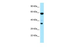 Aviva Systems Biology Corp PPP1CC Antibody - C-terminal region (ARP64668_P050)