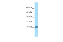 Aviva Systems Biology Corp NDUFA1 Antibody - N-terminal region (ARP64705_P050)