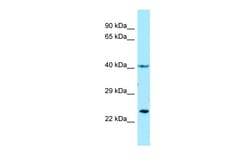 Aviva Systems Biology Corp TBXA2R Antibody - N-terminal region (ARP64719_P050)