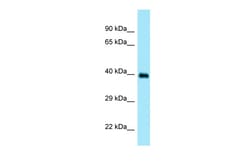 Aviva Systems Biology Corp DOC2A Antibody - N-terminal region (ARP64731_P050)