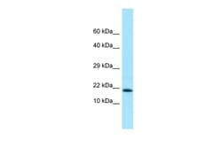 Aviva Systems Biology Corp UBE2V2 Antibody - C-terminal region (ARP64750_P050)
