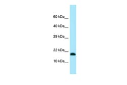 Aviva Systems Biology Corp UBE2V2 Antibody - N-terminal region (ARP64751_P050)