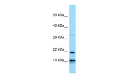 Aviva Systems Biology Corp IL26 Antibody - N-terminal region (ARP64771_P050)