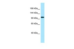 Aviva Systems Biology Corp PKP4 Antibody - N-terminal region (ARP64810_P050)