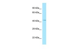 Aviva Systems Biology Corp NADK Antibody - C-terminal region (ARP64835_P050)