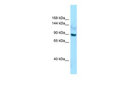 Aviva Systems Biology Corp LRRC7 Antibody - C-terminal region (ARP64881_P050)