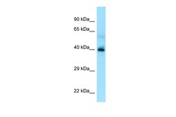 Aviva Systems Biology Corp P2RY13 Antibody - C-terminal region (ARP64923_P050)